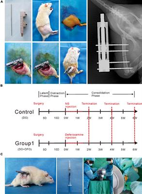 Hypoxia During the Consolidation Phase of Distraction Osteogenesis Promotes Bone Regeneration